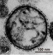 electron microscopy of murine respirovirus virus