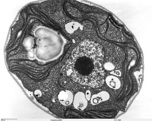 Transmission electron micrograph of Chlamydomonas reinhardtii, a green alga that contains a pyrenoid surrounded by starch.