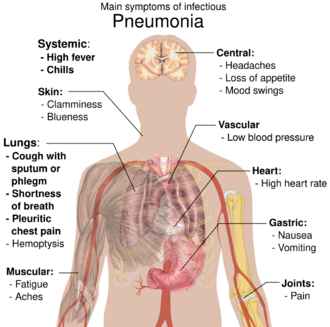A diagram of the human body outlining the key symptoms of pneumonia