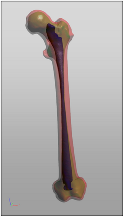 Model of a segmented femur - journal.pone.0079004.g005.png