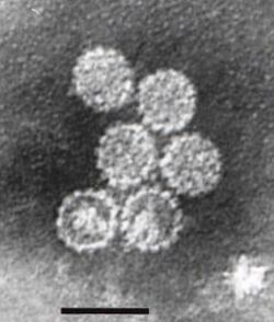 Papillomavirus.jpg