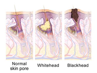 Three images illustrating hair follicle anatomy