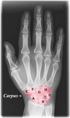 Xray hand with color.jpg