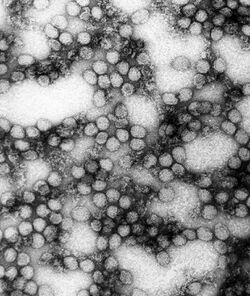 A TEM micrograph of the "Yellow fever virus"