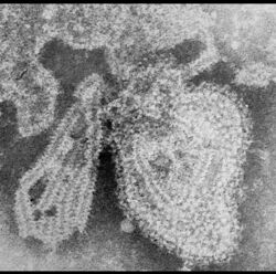 TEM micrograph of a Mumps rubulavirus particle