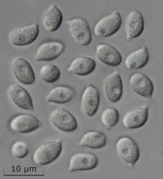 File:Abortiporus biennis spores 1000x.jpg