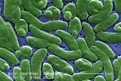 False-color SEM image of "Vibrio vulnificus"