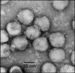 Electron micrograph of negatively stained NDiV virions
