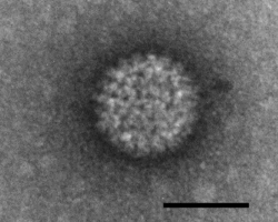 Negatively stained "Bluetongue virus"–like particle that caused a cytopathic effect in BHK-21 cells. Scale bar = 50 nm
