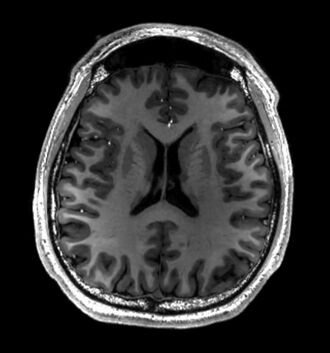 MRI of Human Brain.jpg
