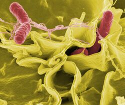 Color-enhanced scanning electron micrograph of red Salmonella typhimurium in yellow human cells