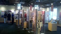 crutches, braces, photographs, and other exhibits
