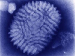 Electron micrograph of Myxoma virus virion