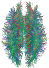 White Matter Connections Obtained with MRI Tractography.png