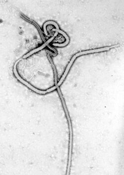 Ebola virus under electron microscope